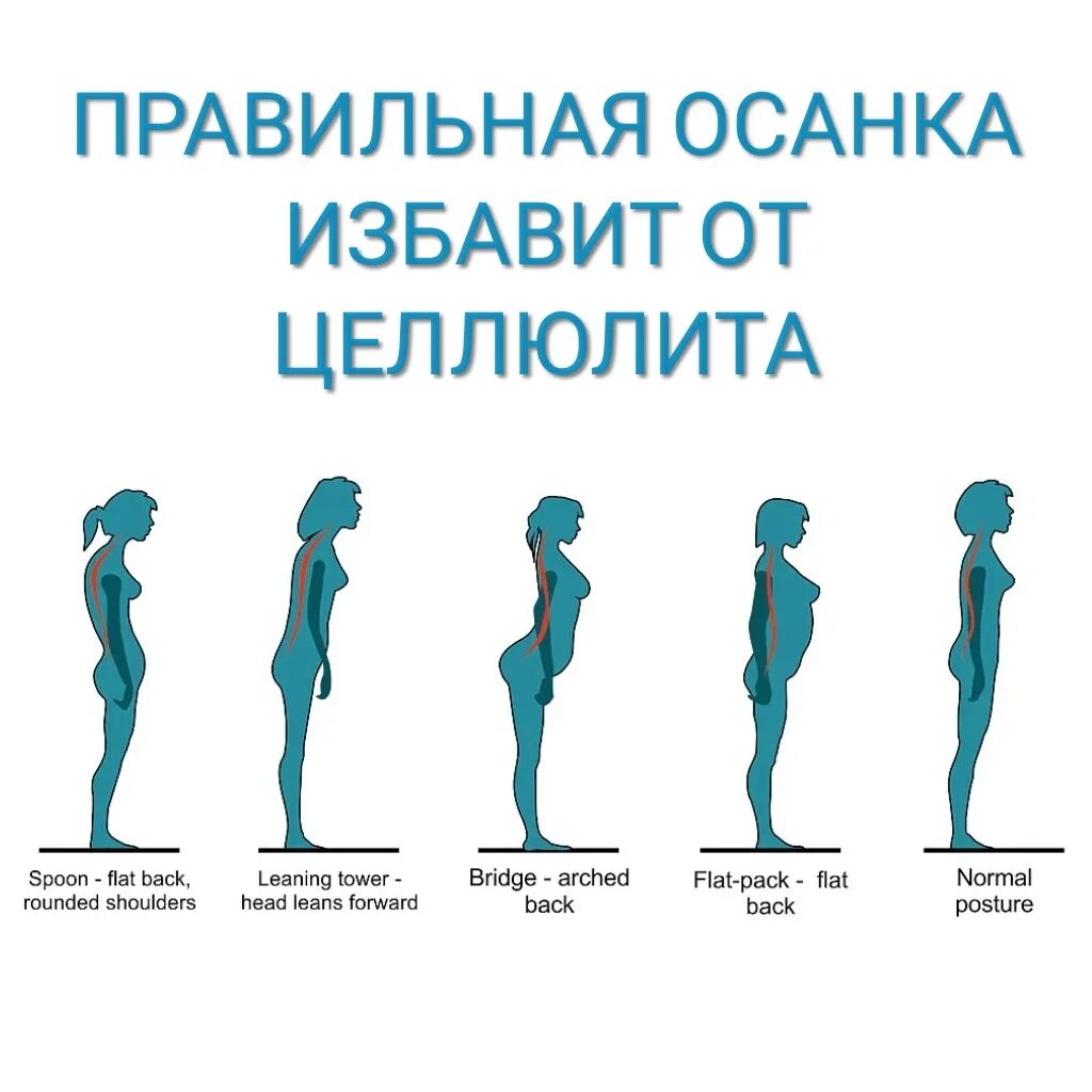 Прогиб в пояснице как называется