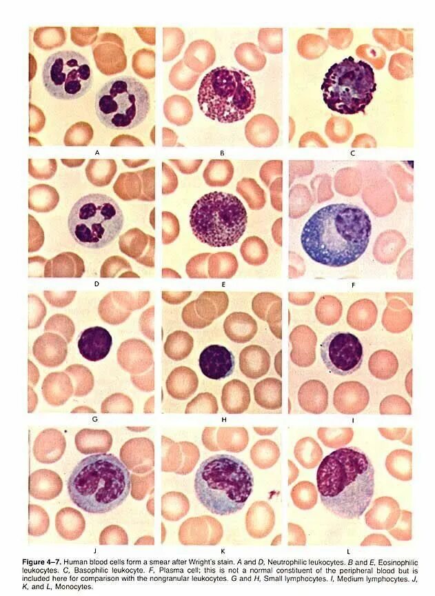 Types and Function of White Blood Cells (WBCs) Blood cells, White blood cell cou