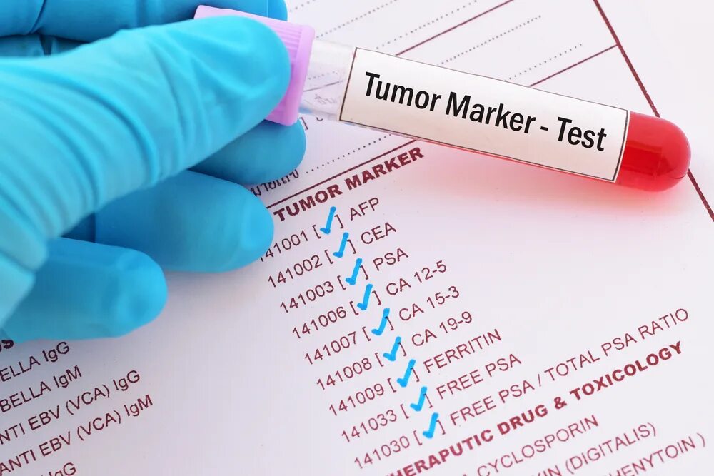 Tumor Marker. Тесты на опухолевые маркеры. Анализ крови. Маркёры это в медицине. Онкомаркеры кишечника инвитро