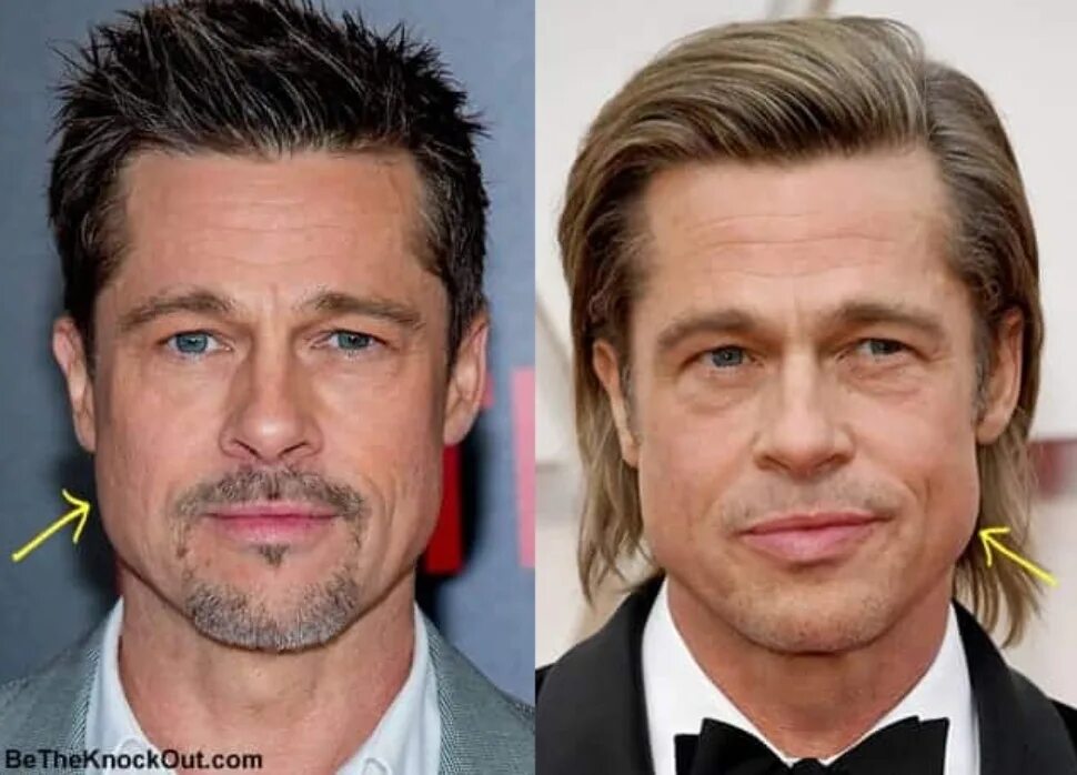 Брэд питт подтяжка 2024. Brad Pitt jawline. Брэд Питт скулы. Брэд Питт челюсть. Брэд Питт jawline.