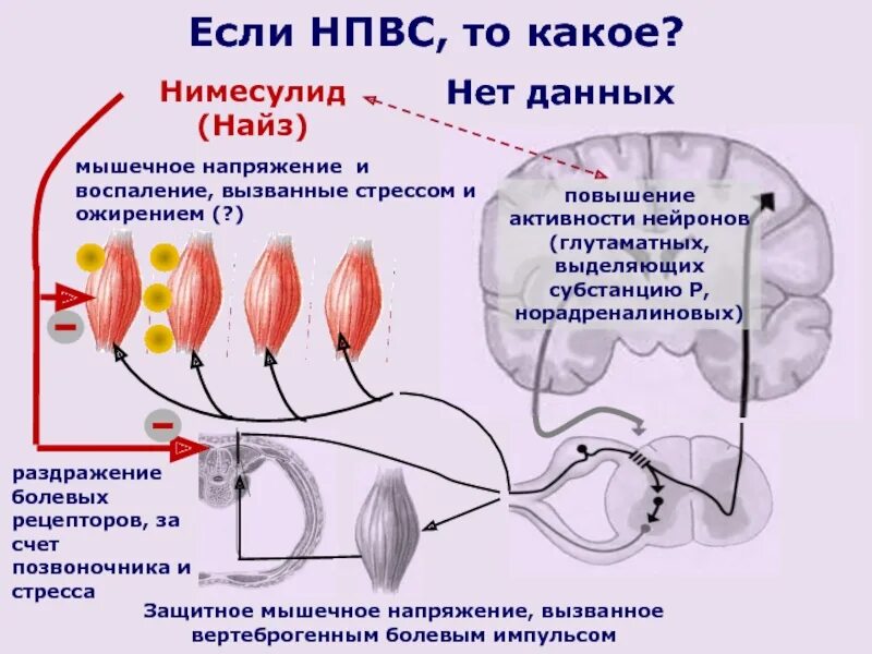 Механизм действия нимесулида. Раздражение болевых рецепторов. Мышечное напряжение. Нимесулид механизм действия. Защитное мышечное напряжение характерно для