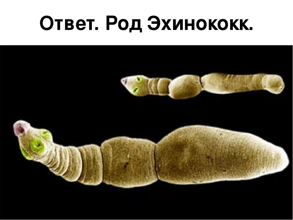 Эхиноккоз