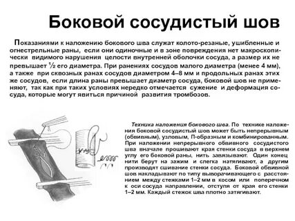 Основные виды сосудистого шва
