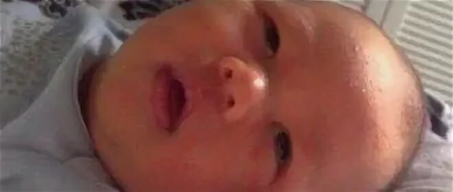 Ребенок засыпает закатывая глаза. Грудничок спит с полуоткрытыми глазами. Закатывание у новорожденного. У ребенка не закатываются глаза. Ребенок засыпает закатывая глаза.