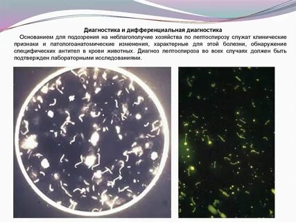 Лептоспироз диагностика