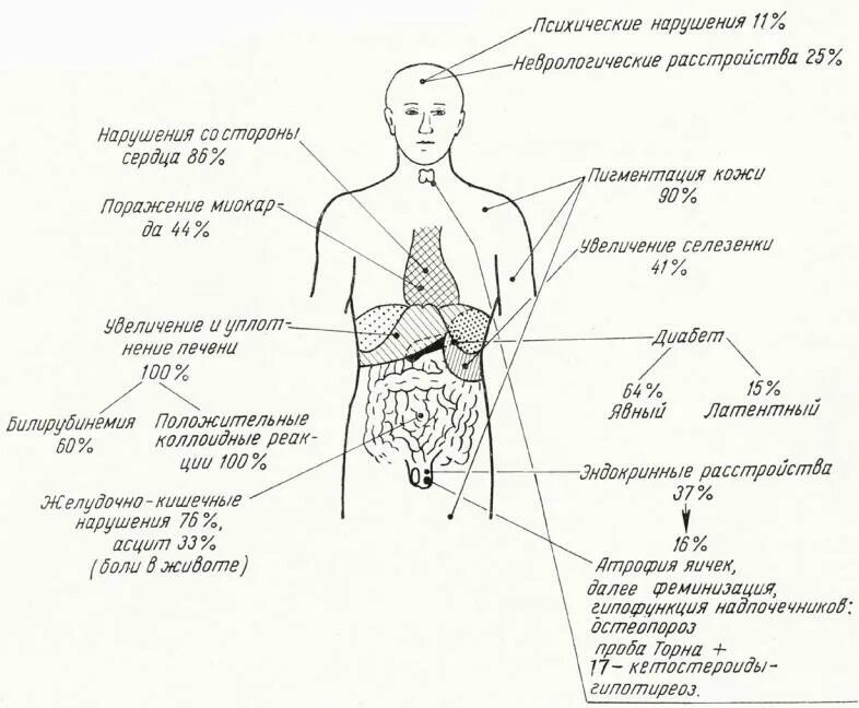 Без гемохроматозов