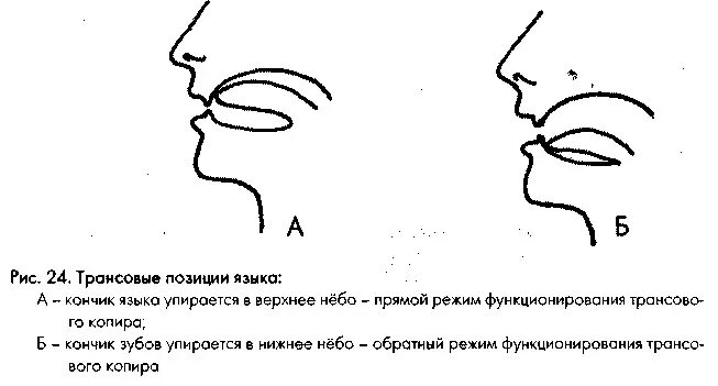 Язык во рту в спокойном состоянии. Правильное положение языка. Правильное положение языка во рту. Положение языка схема.