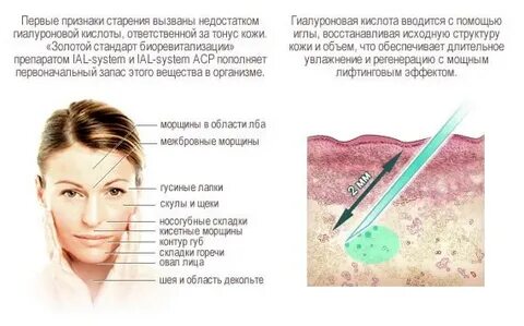 Недостаточно под