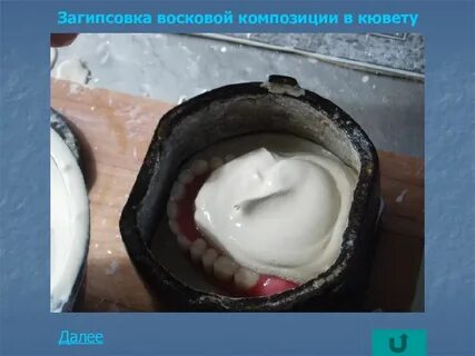 Гипсовка в кювету