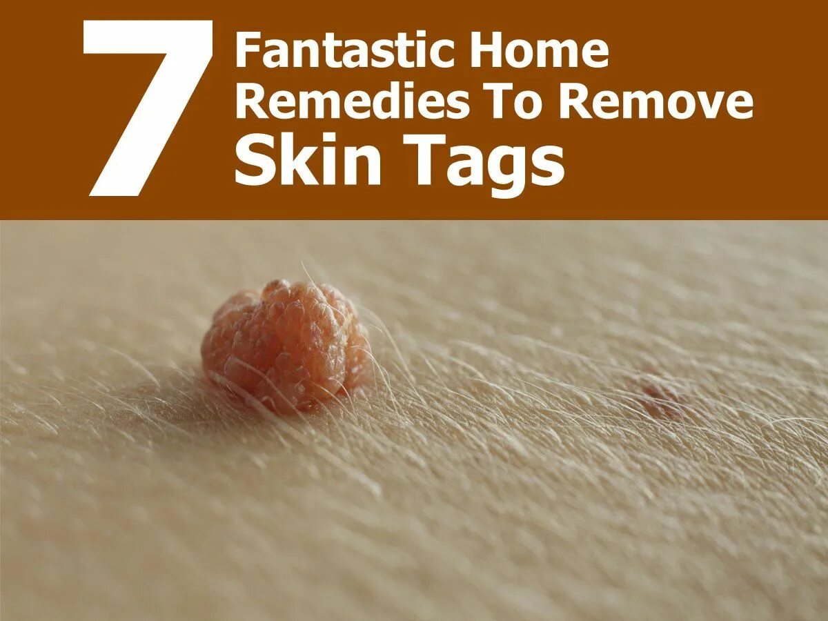 Remove tags. Remove tags