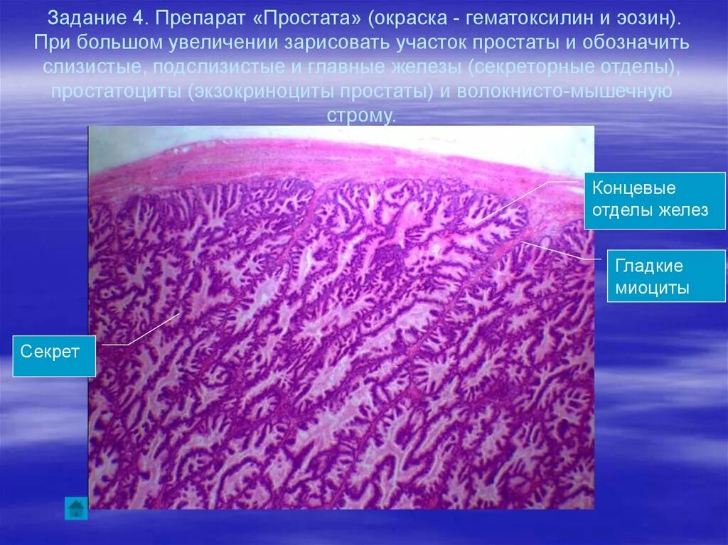 Структура которая образует первичную мочу гистологический препарат. Окраска гематоксилин-эозином в гистологии. предстательная железа окраска гематоксилин эозин. предстательная железа собаки гистология препарат. простата окраска гематоксилин эозин.