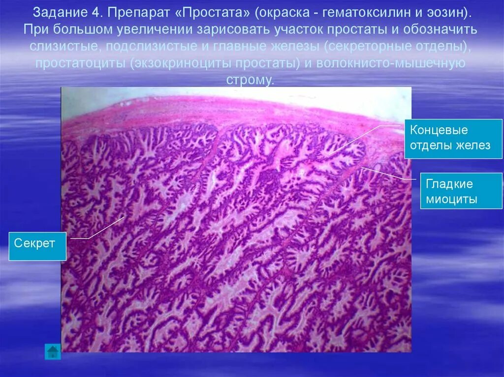 Увеличение больших половых. Окраска гематоксилин-эозином в гистологии. Предстательная железа окраска гематоксилин эозин. Предстательная железа собаки гистология препарат. Строение предстательной железы гистология.