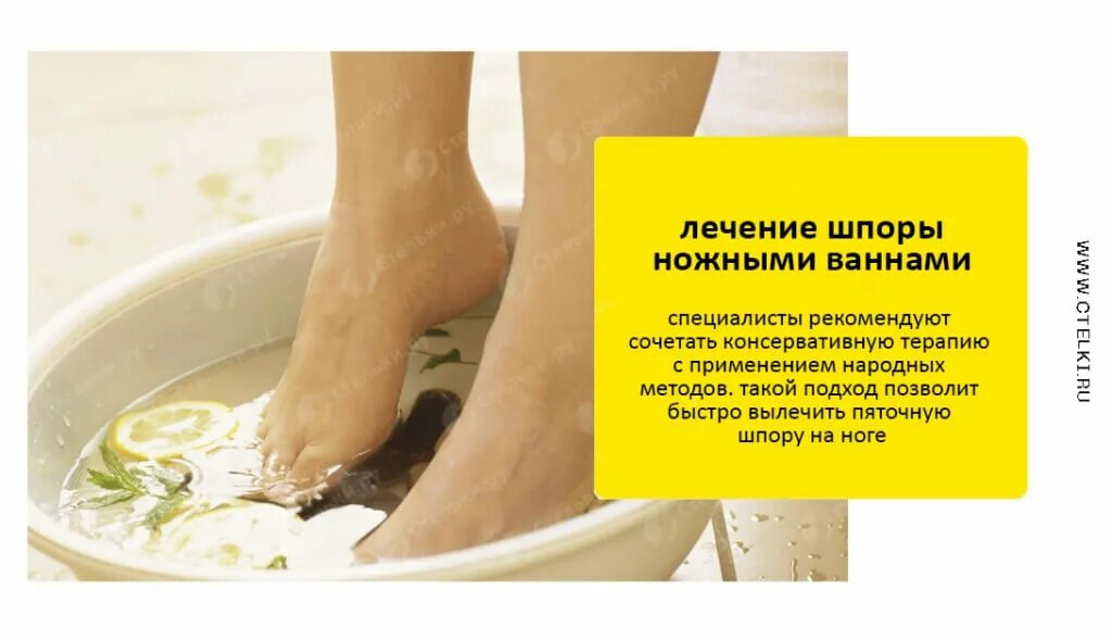 Упражнения при пяточной шпоре. Пяточная шпора парить ноги. Солевая ванночка для ног. Лечение пяточной шпоры народными методами. Чем лечить пяточную шпору в домашних условиях.
