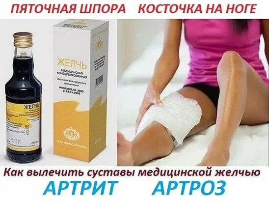 Противовоспалительные при пяточной шпоре. Желчь медицинская. желчь медицинская для суставов. медицинская желчь от косточек на ногах. медицинская желчь при пяточной.