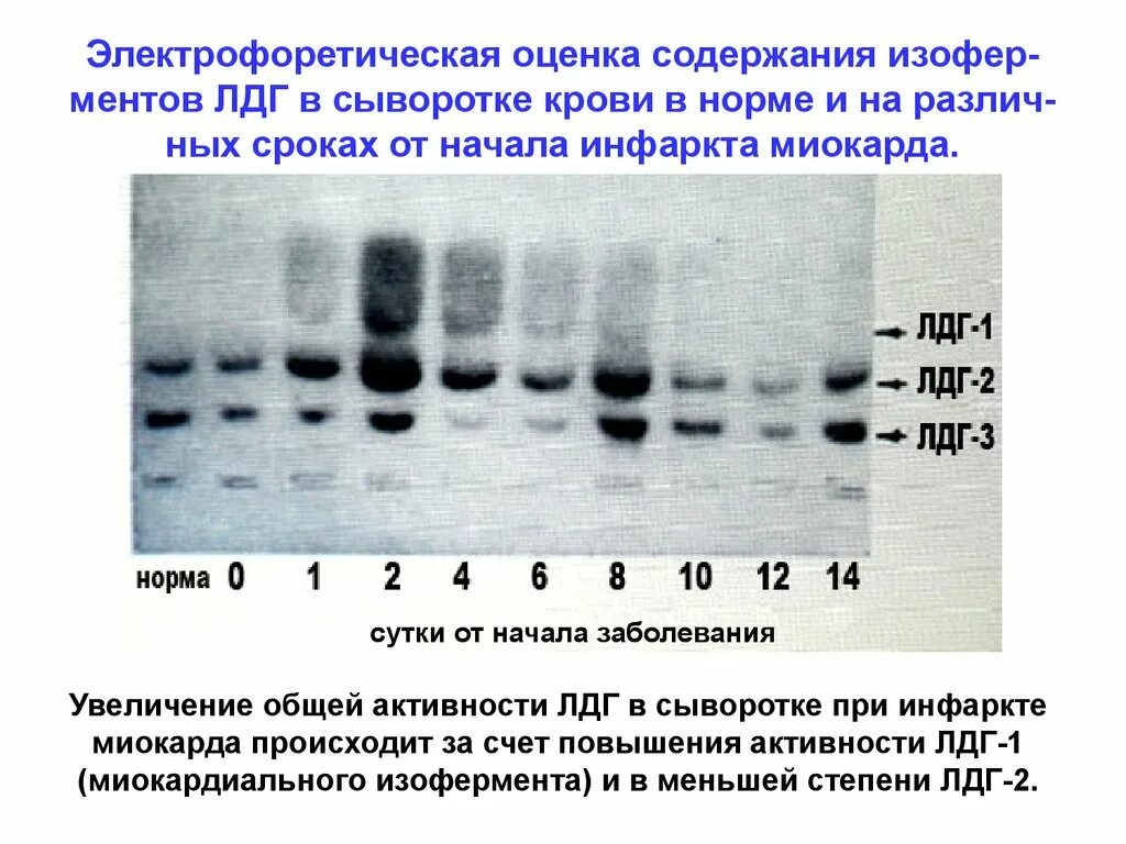 Повышено лдг крови. Лактатдегидрогеназа ЛДГ норма. Определение активности ЛДГ В сыворотке крови. Определение активности лактатдегидрогеназы в крови. Методы определения общей активности ЛДГ В сыворотке крови.