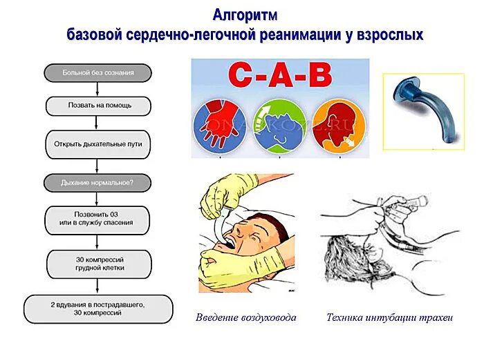 Базовая сердечно легочная реанимация взрослого. Этапы первичной сердечно-легочной реанимации схема. алгоритм базовой сердечно-легочной реанимации слр. современная схема базисной сердечно легочной реанимации. базовая слр алгоритм.