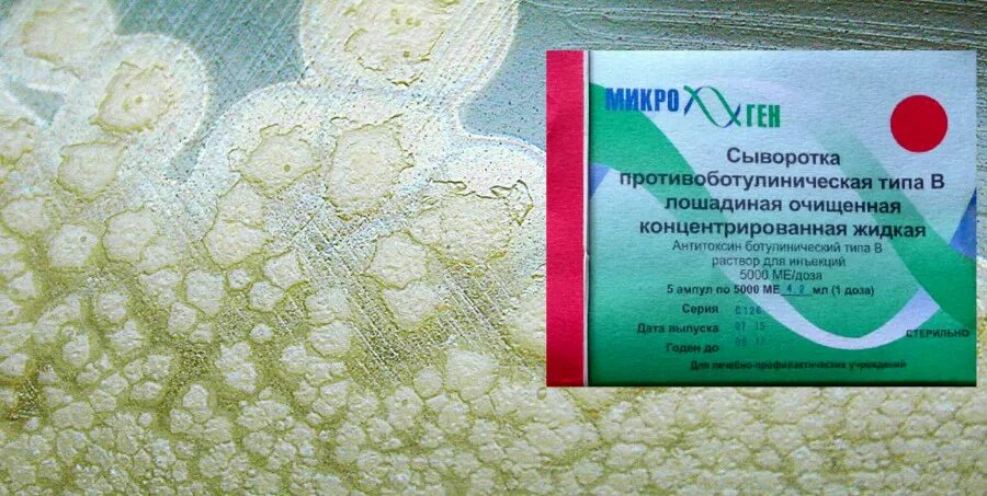 Антитоксическая сыворотка применяется у детей при лечении. Противоботулиническая антитоксическая сыворотка. сыворотка противоботулиническая типа е 10000 ме. сыворотка против ботулизма. название сыворотки от ботулизма.