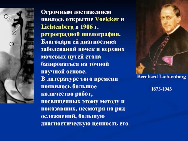 Эффект открыл ученый Лихтенберг. 1906 Году f. Voelcker и a. Lichtenberg. Ретроградного дренирования верхних мочевых путей на мониторе. История урологии