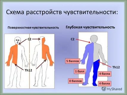 Нарушение чувствительности латынь