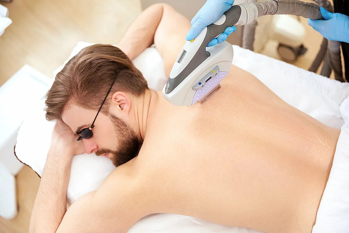 Laser epilation man hair. Лазерная эпиляция. Лазерная эпиляция для мужчин. Зону фотоэпиляция