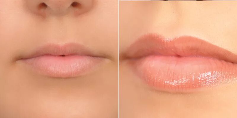Губы в мл сколько стоит. Перманентный макияж губ до и после. Коррекция губ. Коррекция губ гиалуроновой кислотой.