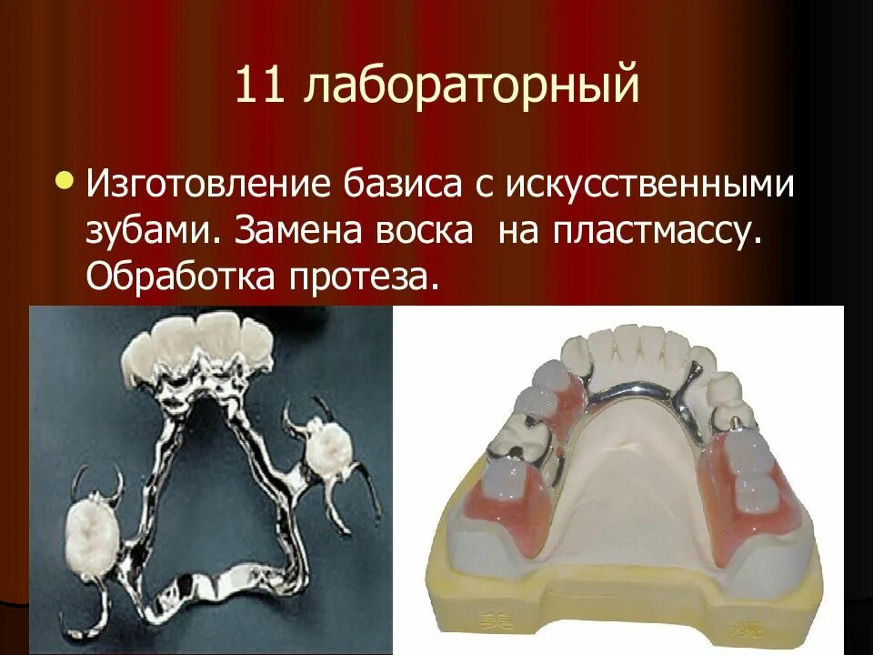 Бюгельные протезы клинико-лабораторные этапы. Клинико лабораторные этапы бюгельного протеза. Бюгельный протез Базис. Этапы изготовления бюгельного протеза. Бюгельные протезы лабораторные этапы