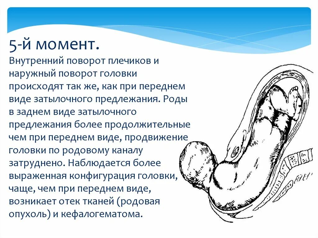 Биомеханизм при заднем виде затылочного предлежания. Задний вид затылочного предлежания биомеханизм родов. внутренний поворот плечиков и наружный поворот головки. при переднем виде затылочного предлежания. биомеханизм родов при затылочном предлежании 5 момент.