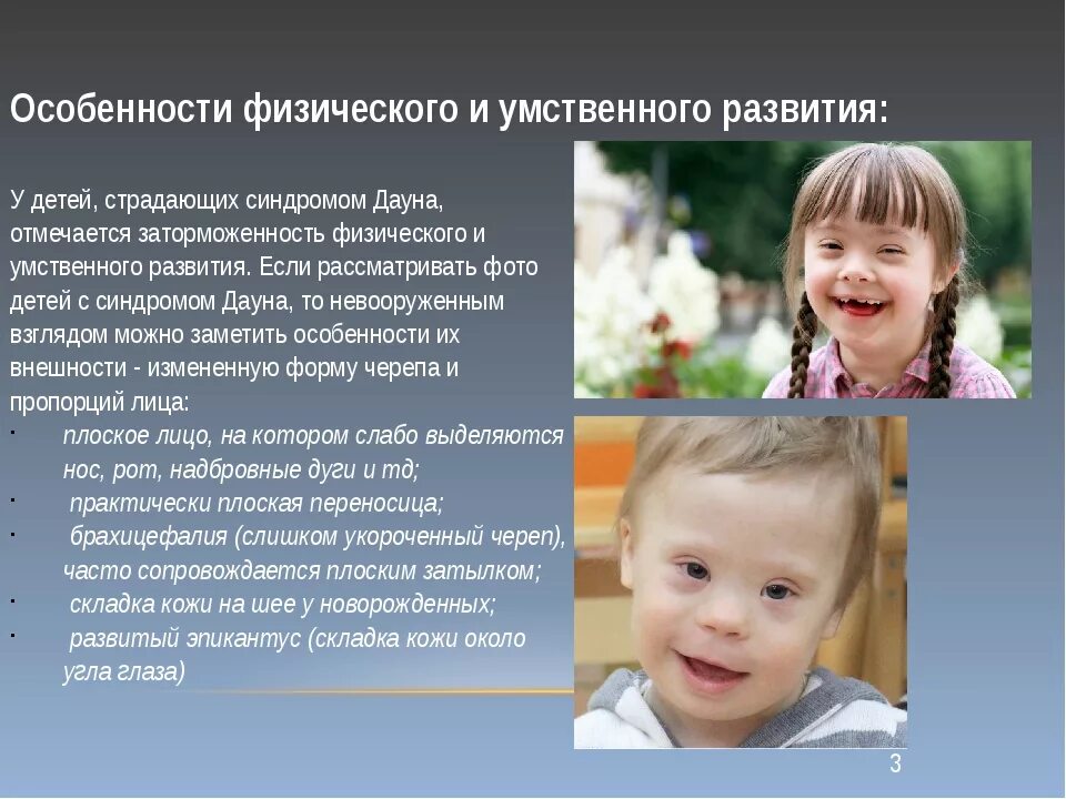 Синдром Дауна признаки у детей. Особенности развития детей с синдромом Дауна. Почему даунов называют даунами
