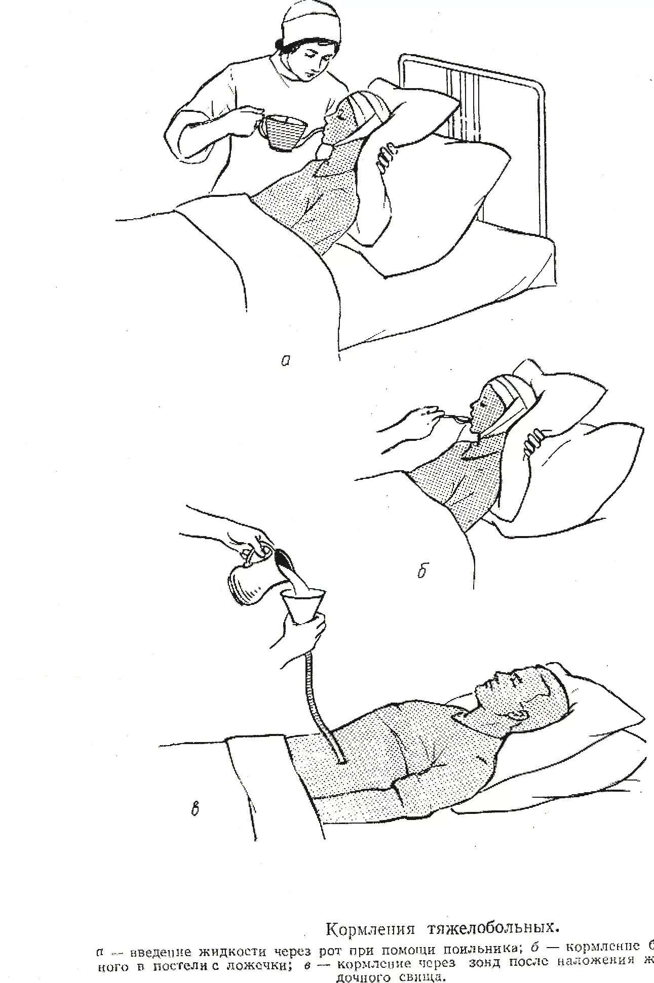 Кормление тяжелобольного пациента в постели. Кормление тяжелобольного пациента при помощи поильника. питание тяжелобольного пациента через зонд. кормление тяжелобольного пациента алгоритм. алгоритм кормления тяжелобольного пациента через ложечку и поильник.