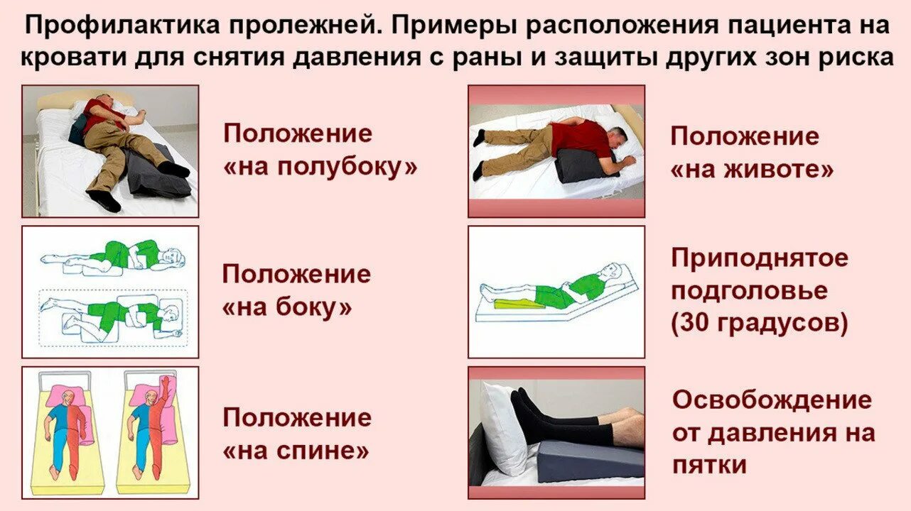 Сколько еды лежачему больному. Пролежни у тяжелобольных пациентов профилактика пролежней. Профилактика пролежнч. Пролежни памятка для пациента. Профилактика пролежней памятка.