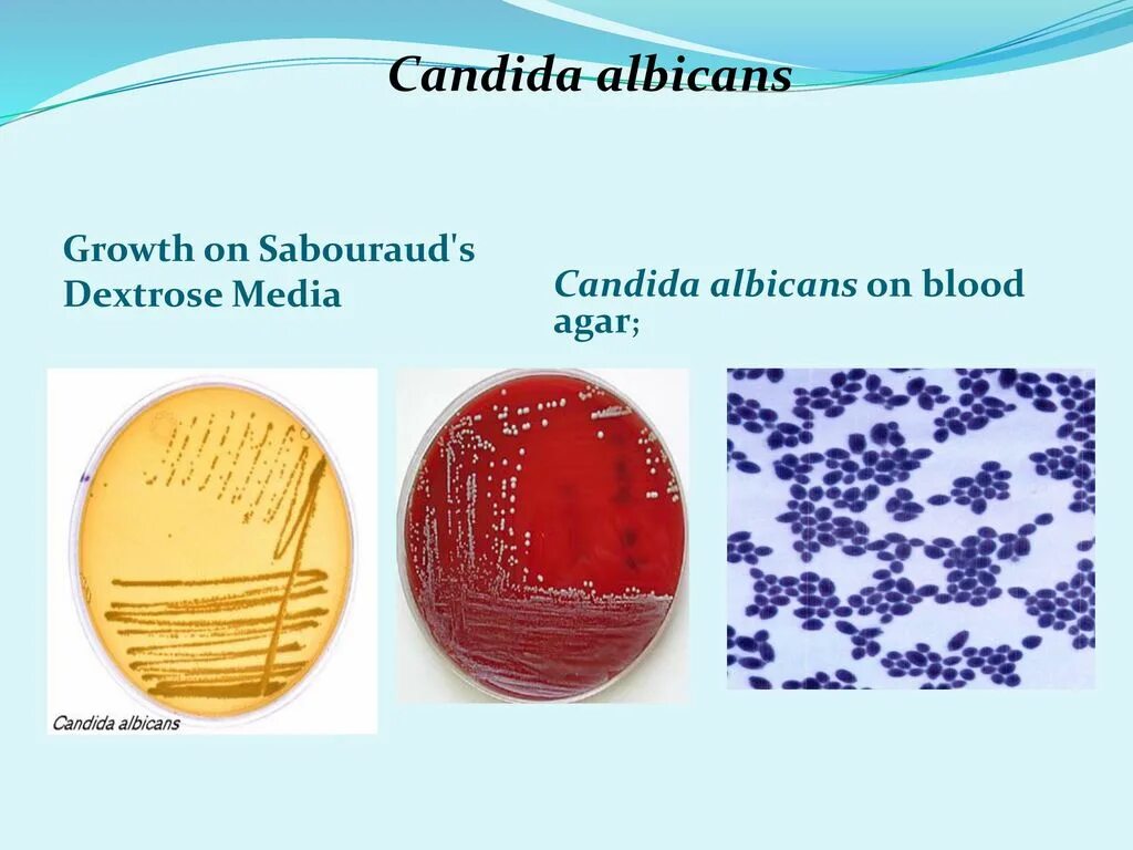 Грибы candida albicans. Candida альбиканс. Candida albicans псевдогифы. Грибы кандида микроскопия.