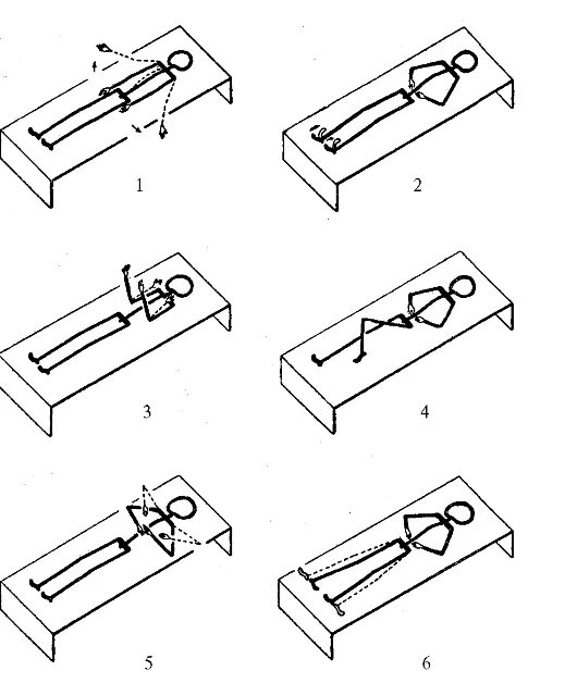 лфк по гориневской древинг при компрессионном переломе позвоночника. лфк прикампрессионной переломе позвоночника. лечебные физические упражнения. упражнения при реабилитации после перелома позвоночника. комплекс упражнений для мышц.