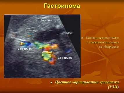Образование без кровотока