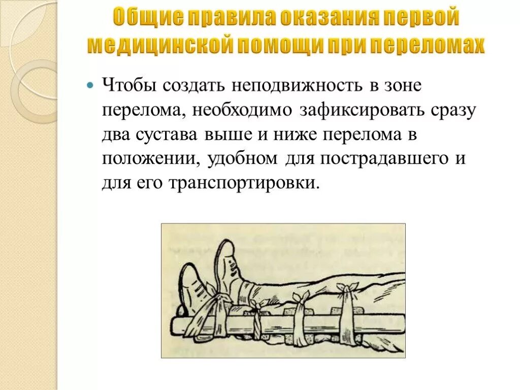 При открытом переломе пострадавшему необходимо. Порядок оказания первой помощи при переломах. Первая медпомощь при открытом переломе.