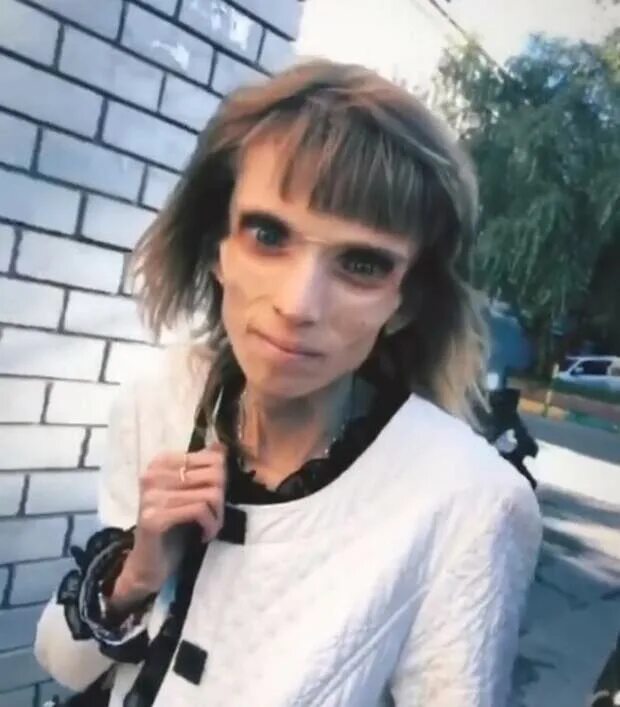 Девочка весит 17. Кристина корягина сейчас 2020. Кристина корягина анорексия 2021. Девочка весит 17. Кристина корягина сейчас 2020.