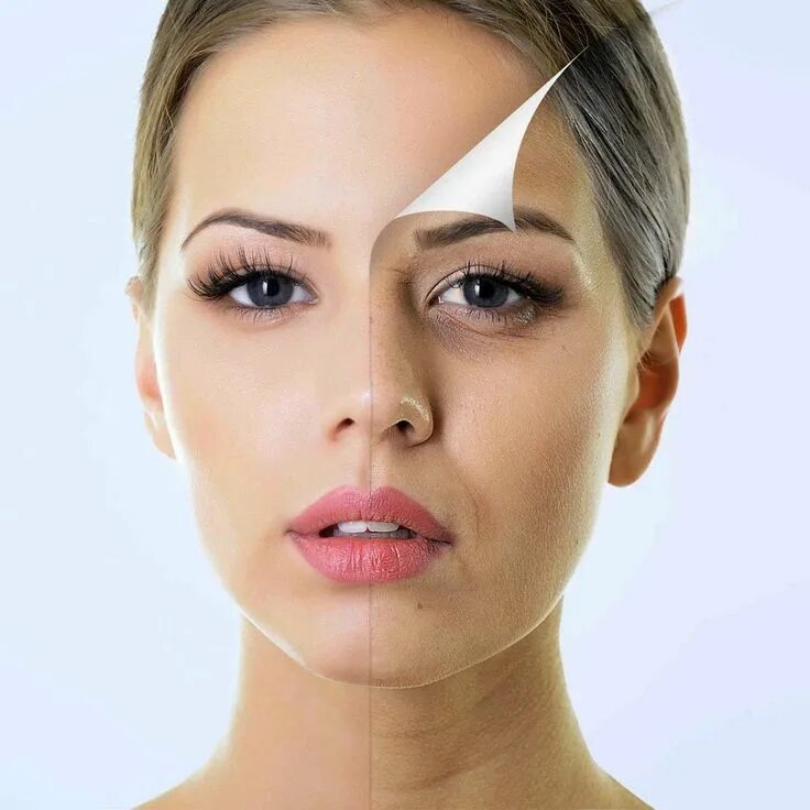 Eye peel. Eye peel
