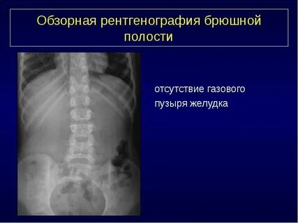 Отсутствие полости