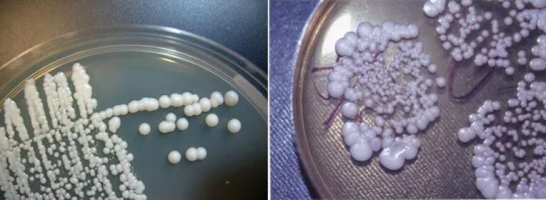 Грибы кандида в организме. Грибы рода candida вызывают болезни. Кандидомикоз кандида-агар. Грибы кандида под микроскопом. Дрожжи грибы рода кандида.