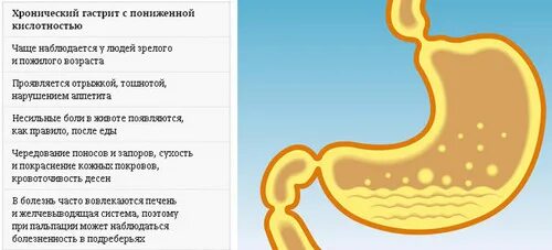 Низкая кислотность желудка. Желудок с повышенной кислотностью. Повышенная кислотность желудка. Желудок с пониженной кислотностью. Понижена кислотность желудка признаки