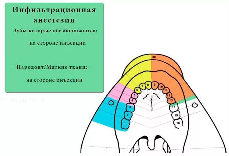 Сколько отходит наркоз зуба. Сколько отходит наркоз зуба