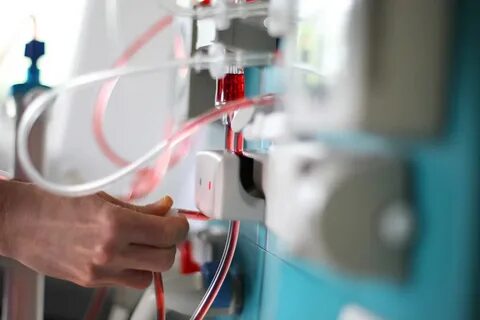 Почки процедуры