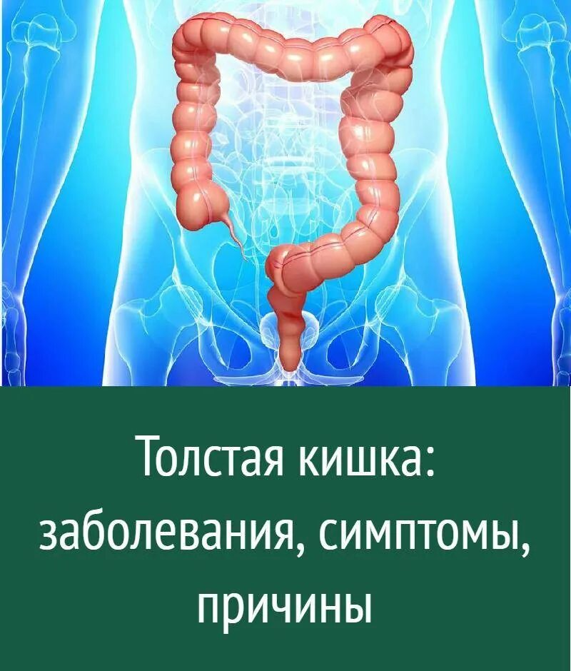 Какие могут быть болезни кишечника