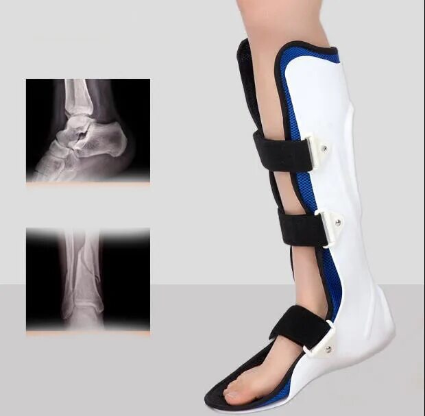 Easy walk talarmade ортез голеностопный. Лангетка на стопу при переломе. Лангетка на стопу при переломе. Тутор (сапог) с пневмофиксацией для голеностопного сустава xp walker. Лангетка на стопу при переломе.