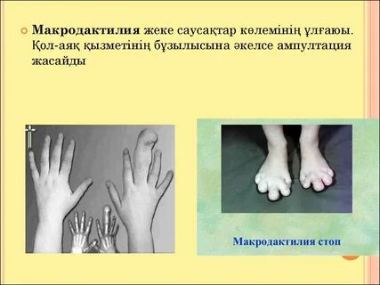 Жыныстық қатынас кезіндегі веб-камера