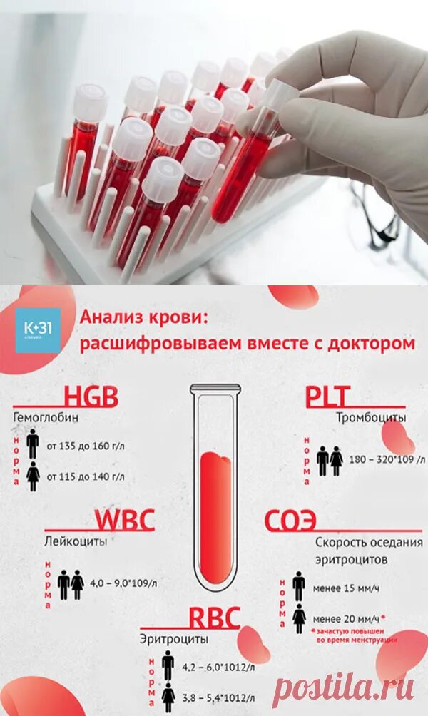 Подготовка к сдаче анализов биохимии. Анализ крови. Исследование анализа крови. Клиническое исследование крови. Общие клинические исследования крови.