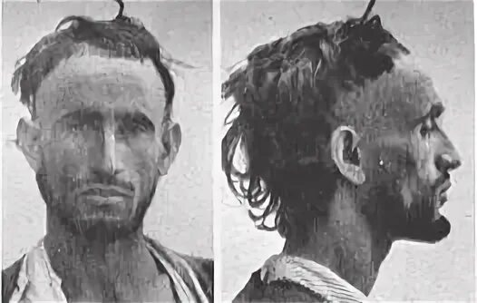 Балкано-кавказская раса арменоидный. Балкано-кавказская раса арменоидный тип. Антропологический тип северный понтид. Средиземноморская раса. Европеоидная балкано кавказская раса.