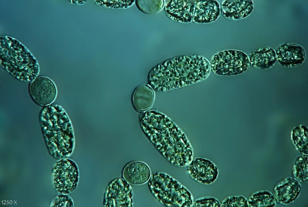 Anabaena цианобактерия. Anabaena цианобактерия строение. цианобактерии анабена. анабена водоросли. цианобактерии анабаена.
