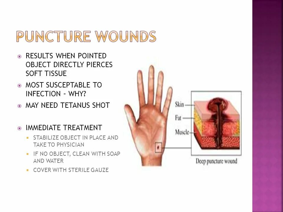 Types of wound. Types of wound