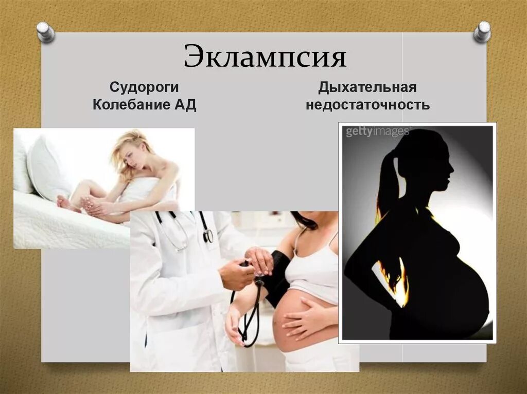 Эклампсия это у беременных. Эклампсия. эклампсия беременности. преэклампсия беременных презентация. приступ эклампсии у беременных.