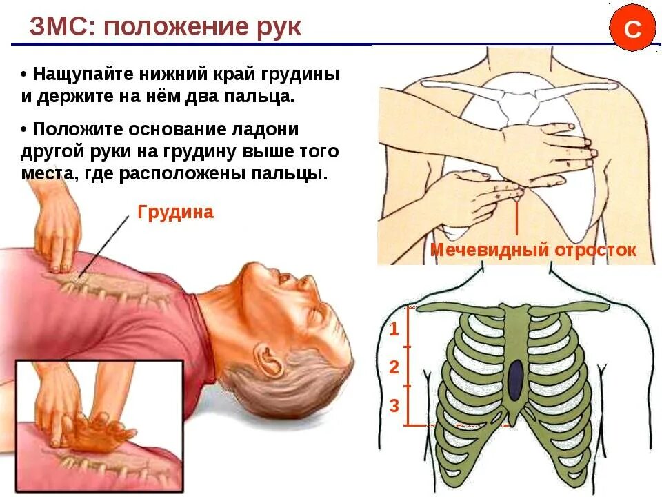 Мечевидный отросток грудины где находится у человека. Мечевидный отросток грудной клетки. Мечевидный отросток грудной клетки человека. Функции мечевидного отростка грудины. Осложнения при закрытом массаже сердца